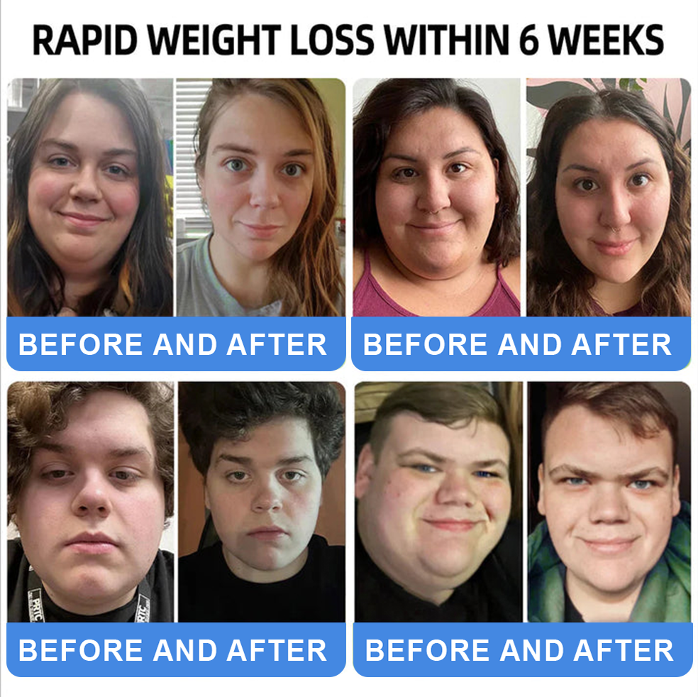 ใLast Day Promotion 66% OFF๐ฅใ ๐ช๐๐๐๐๐ยฎ NIDDK-Tirzepatide Oral Solution ๐Use once every two days, | Lose 20 pounds quickly | Reduce sugar by 90% |) (Copy)